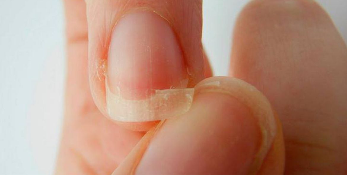 Remedios para evitar las uñas quebradizas
