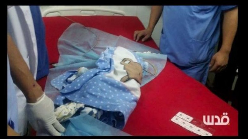Bebé palestino muere por inhalación de gas lacrimógeno israelí