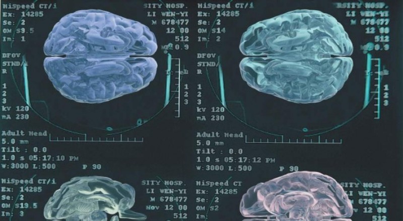 Un estudio niega que pueda hablarse de un cerebro masculino y otro femenino