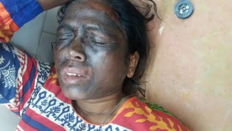 Rocían con una sustancia química la cara de una política y activista tribal india