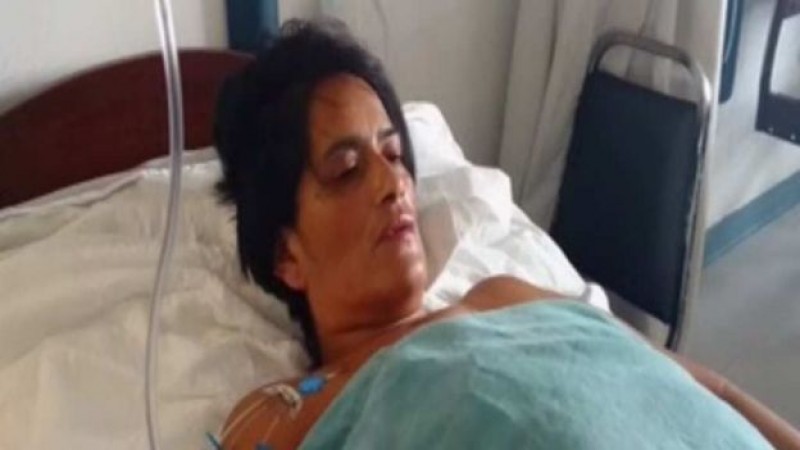 Golpiza de su pareja, deja a mujer sin caminar