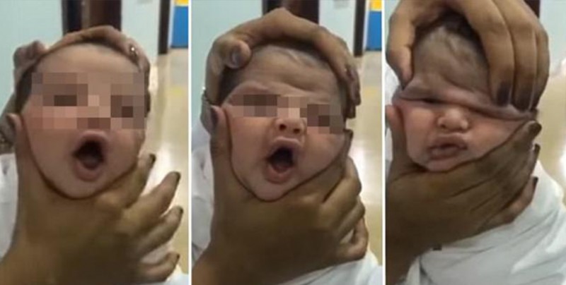 Enfermeras despedidas por "jugar" con el rostro de un bebé