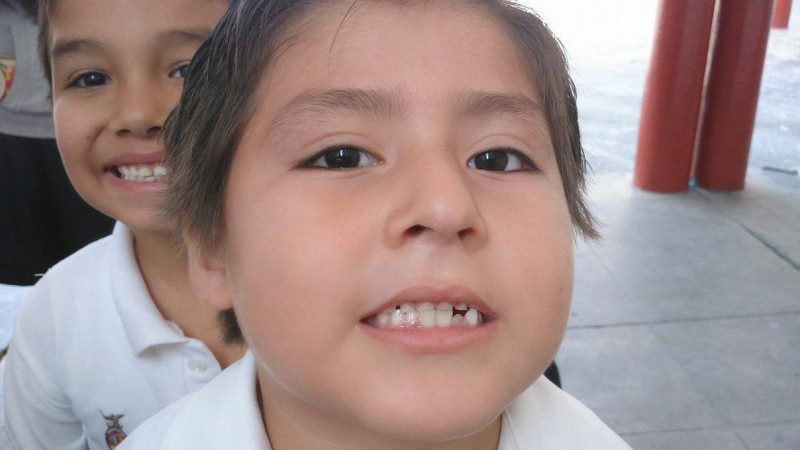 DIF Sinaloa contribuye a acciones de salud bucal