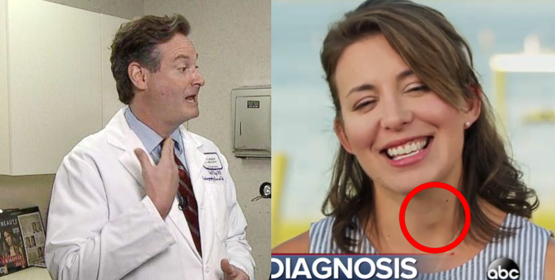Un doctor descubre que una mujer tiene cáncer después de verla por televisión