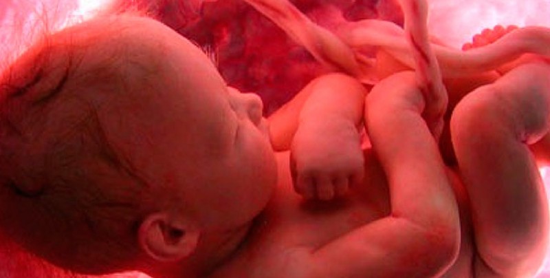 Mujer embarazada se salva luego de operación para extraer útero con bebé