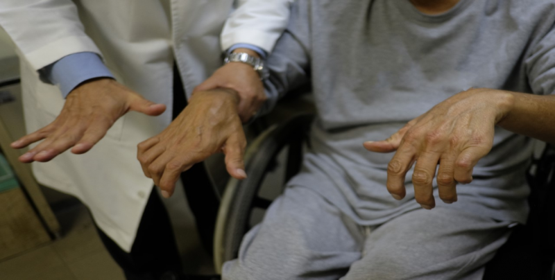 1.5% de la población padece artritis reumatoide en México