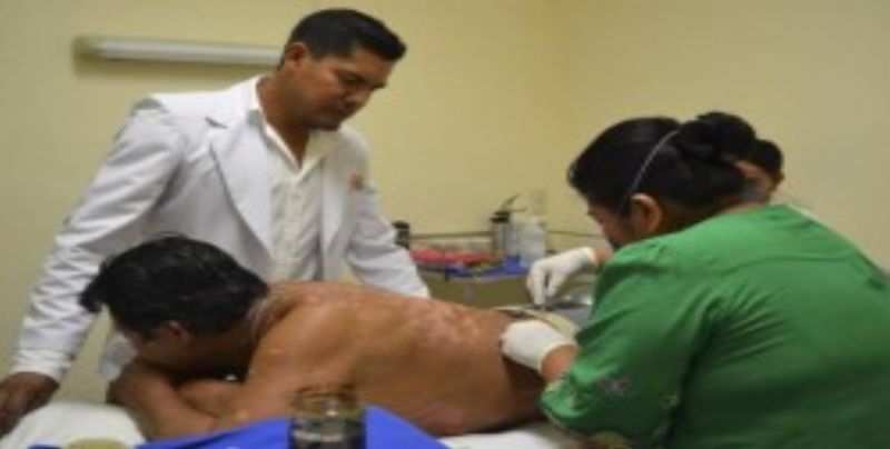 En Sinaloa  hay 171 pacientes con lepra en control y 49 están en tratamiento