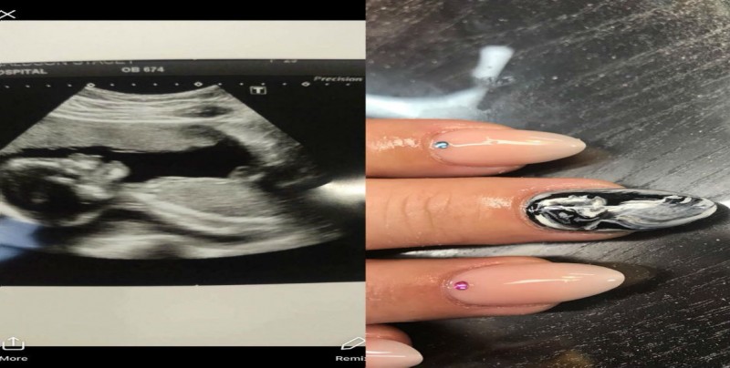 Embarazadas imponen moda al usar sus ecografías en uñas