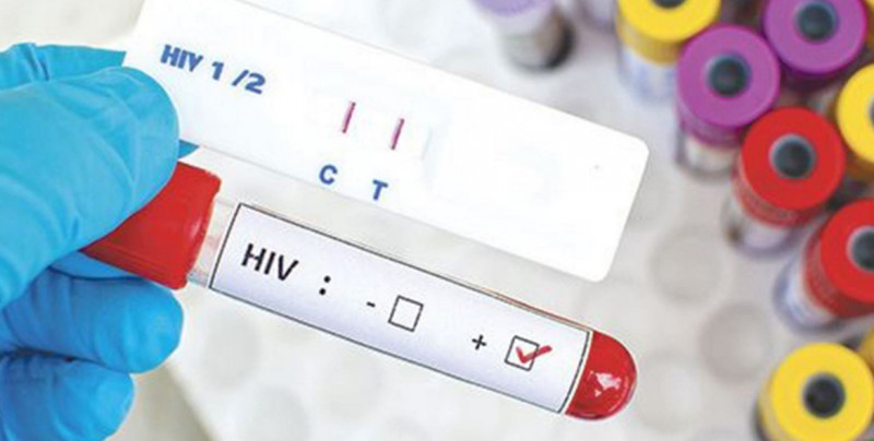 Primera vacuna contra el VIH comenzará a circular en 2023