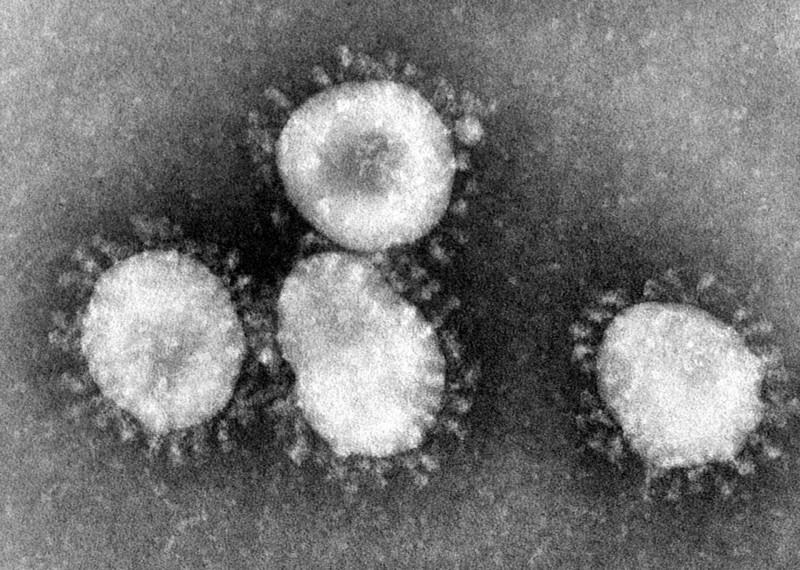 Medidas de prevención por coronavirus