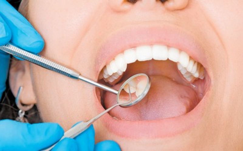Odontología preventiva en niños , indispensable para evitar enfermedades
