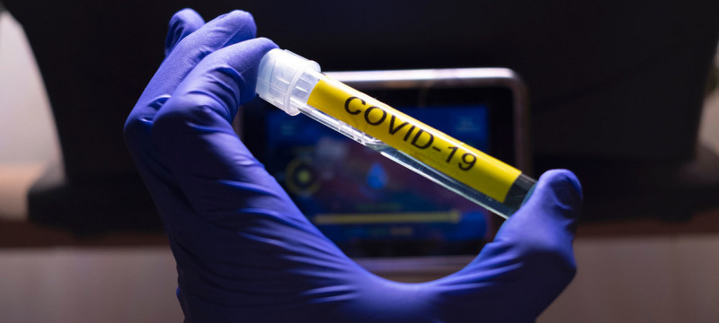 Estudio indica que un parásito podría ser capaz de destruir al Covid-19