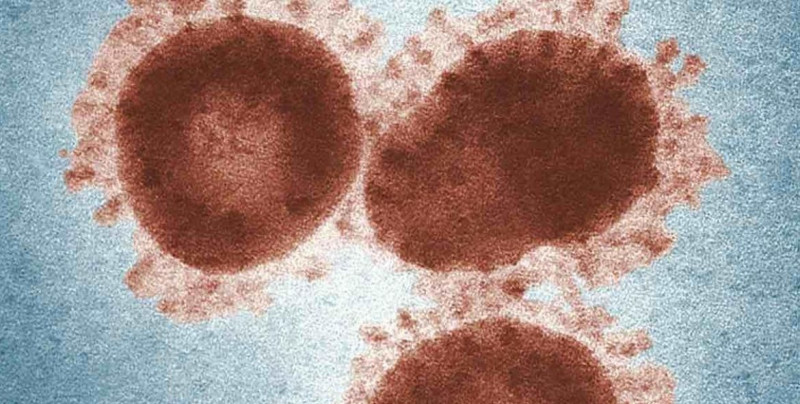 Encuentran tres casos de mutación D614G de Coronavirus  en Malasia: 10 veces más infecciosa que Covid-19