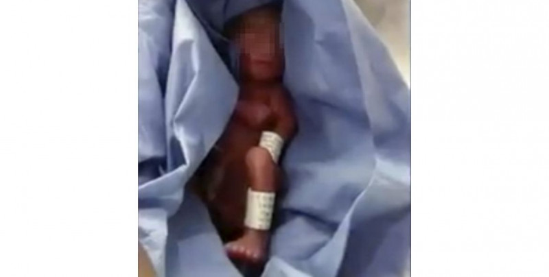 IMSS da por muerto a bebé prematuro y su padre lo encuentra vivo en la morgue