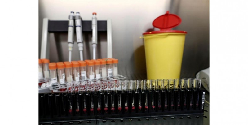 Vacuna rusa "EpiVacCorona" brindará inmunidad de al menos medio año y podría durar hasta año y medio