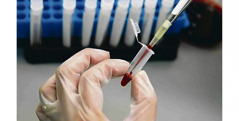 Vacuna española contra el VIH muestra grandes resultados para tratar el virus