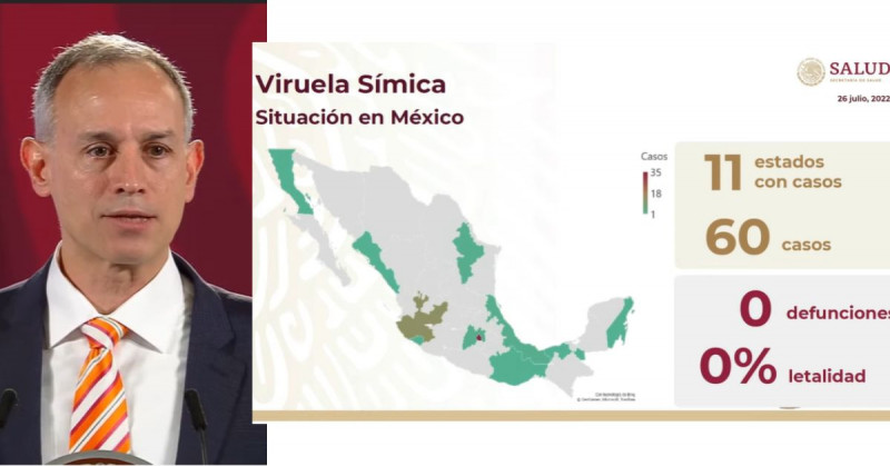 México ya tiene 60 casos confirmados de Viruela del Mono: López-Gatell