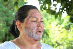 Secretaría de salud confirma otra persona afectada por agua del Río Sonora