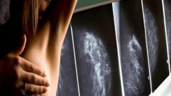 IPN crea método para detectar cáncer de seno