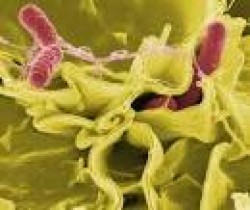 Mantenga la higiene, para prevenir la fiebre Tifo
