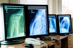 Diseña mexicano software para aprendices de radiología y ortopedia