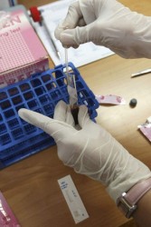 La vacuna terapéutica para combatir el VIH se empezará a suministrar a humanos en 2016