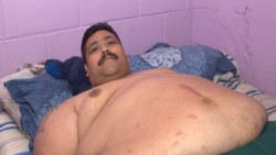 Operarán en México al más obeso del mundo