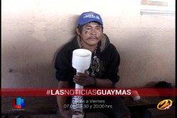 Fabrica una prótesis casera