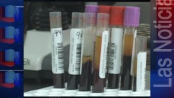 El virus del Zika podría contagiarse teniendo relaciones sexuales