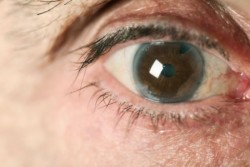 En México 7 de cada 10 personas desconocen padecer glaucoma