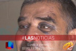 Señala haber sido golpeado por sus sobrinas