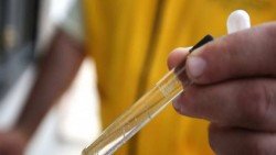 Confirman 183 casos de Zika en México; 42 son embarazadas