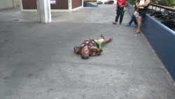 Caso de epilepsia no atendido por el Hospital General
