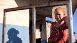 En África matan a las personas que nacen albinas