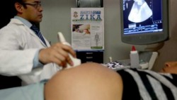 Detectan en España el primer caso de microcefalia en feto por zika