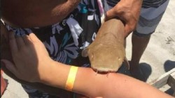 Mujer llega a hospital con tiburón en el brazo