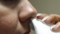 Alergias deben de ser atendidas por especialistas