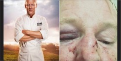 Reconocido chef recibe paliza por "parecido" con Trump