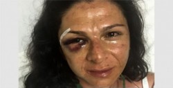 Publican video del momento de la agresión a Ana Gabriela Guevara