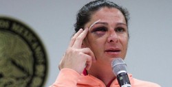 Acusan a Ana Gabriela Guevara de golpear primero a su agresor