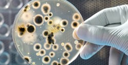 OMS da a conocer lista de bacterias que ponen en riesgo a la humanidad