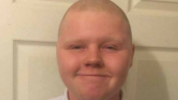 Se rapó para apoyar a su amigo con cancer y lo suspendieron de la escuela