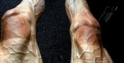 Así lucen las piernas de un ciclista tras participar en el Tour de France