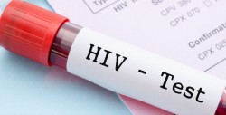 Fiebre y escalofríos podrían ser indicios de VIH: especialista