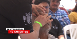 Entregan DIF y UNAM prótesis oculares en Mazatlán