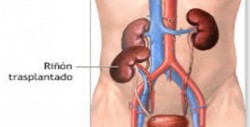 Recomienda IMSS cuidar los riñones