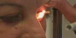 Consultas gratis para detectar glaucoma