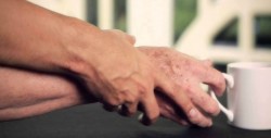 Atiende IMSS a 300 mil derechohabientes con Parkinson