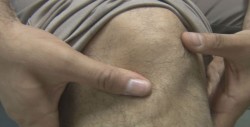 Desgaste de rodilla, cada vez más frecuente