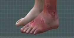 La droga Krokodil es más fuerte 10 veces que heroína